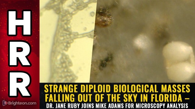 Strange diploid biological masses falling out of the sky in Florida – Dr. Jane Ruby joins Mike Adams for microscopy analysis