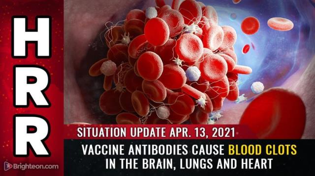 Vaccine antibodies CAUSE blood clots in the brain, lungs and heart